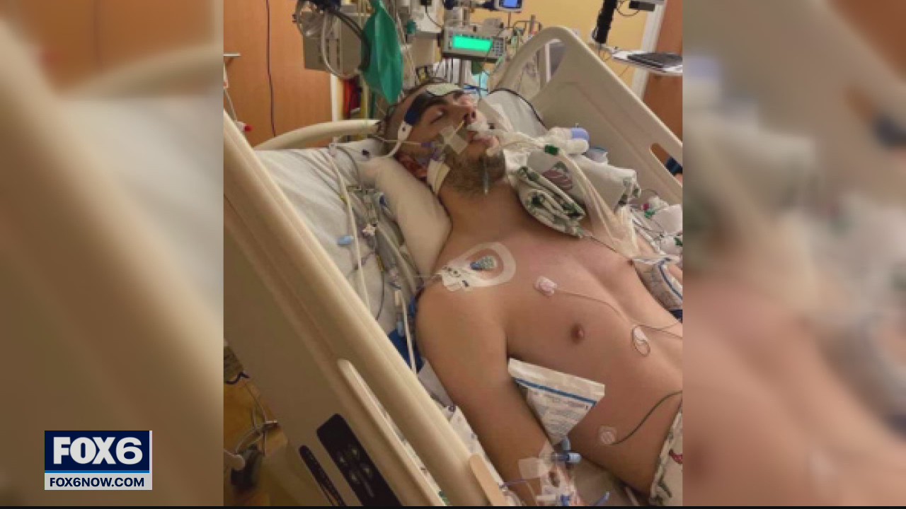 Brookfield East's top varsity racer in coma after ski accident