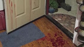 Man attacked with machete after confrontation