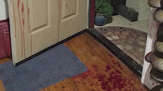 Man attacked with machete after confrontation