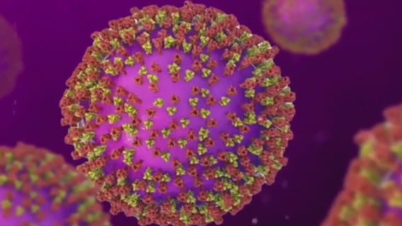 CDC warns of accelerating measles outbreak