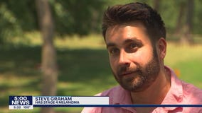 Minnesota father talks his battle with melanoma