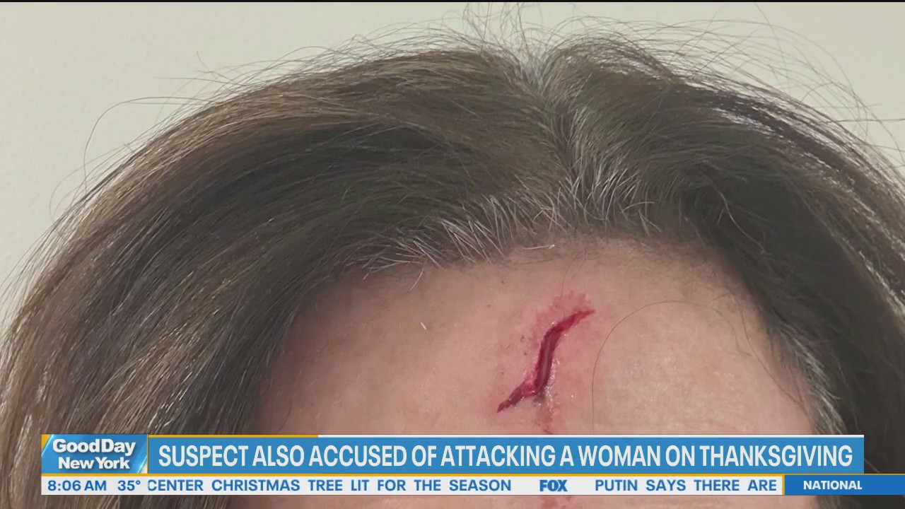 Suspect in NYU student attack pleads not guilty, as another alleged victim comes forward