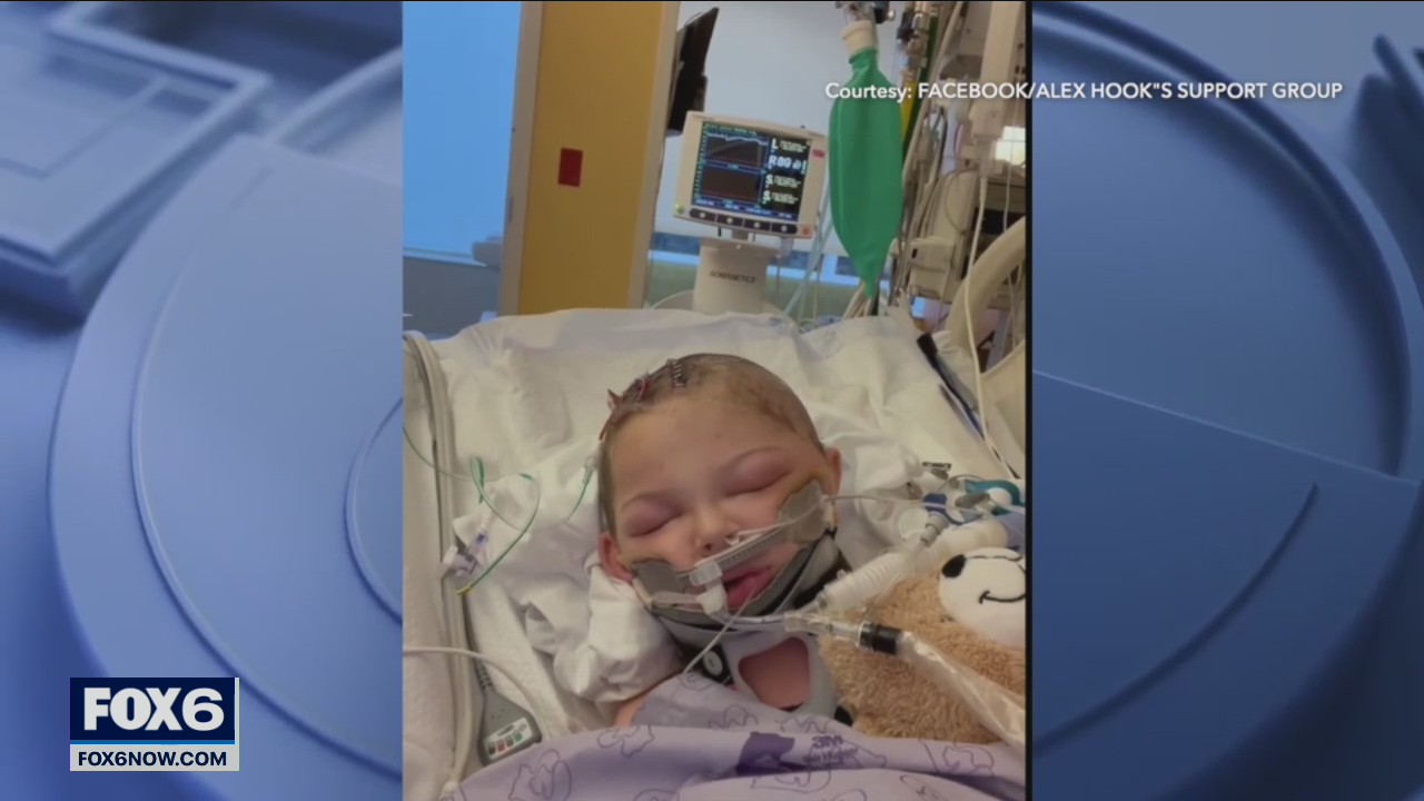 Mom of boy struck by projectile at recess shares update
