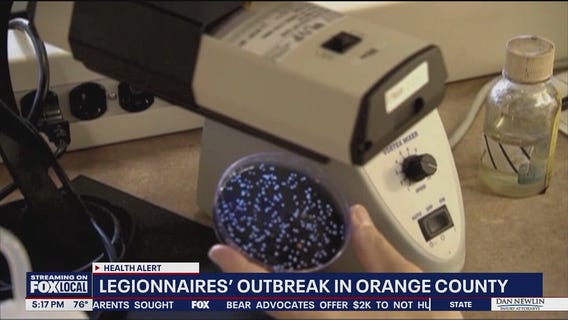 14 Legionnaires’ cases linked to Orange County gym