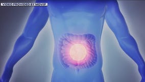 How to strengthen your gut to improve your health