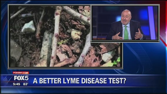 New Lyme disease test?