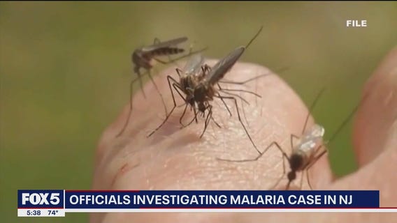 NJ resident infected with malaria, state officials investigate