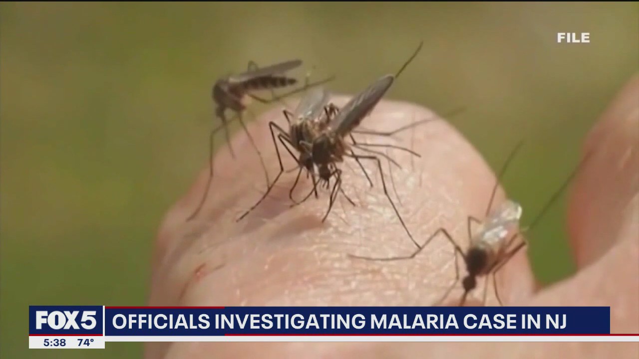 NJ resident infected with malaria, state officials investigate