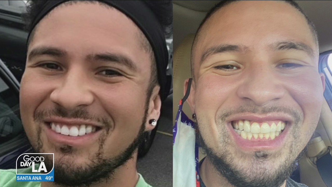 What you should know about the link between Covid-19 & your Dental Health