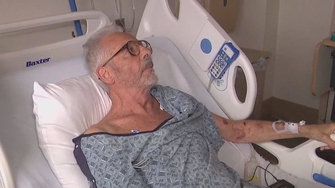 Vet who shot naked intruder speaks out