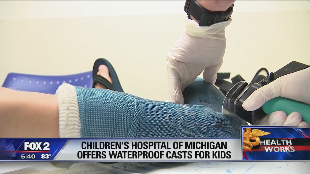 Waterproof casts are now on the market