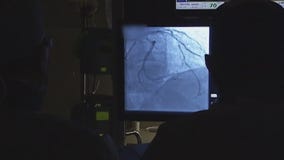 What is cardiac rehab and who needs it?