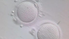 Birth control for men passes safety trial