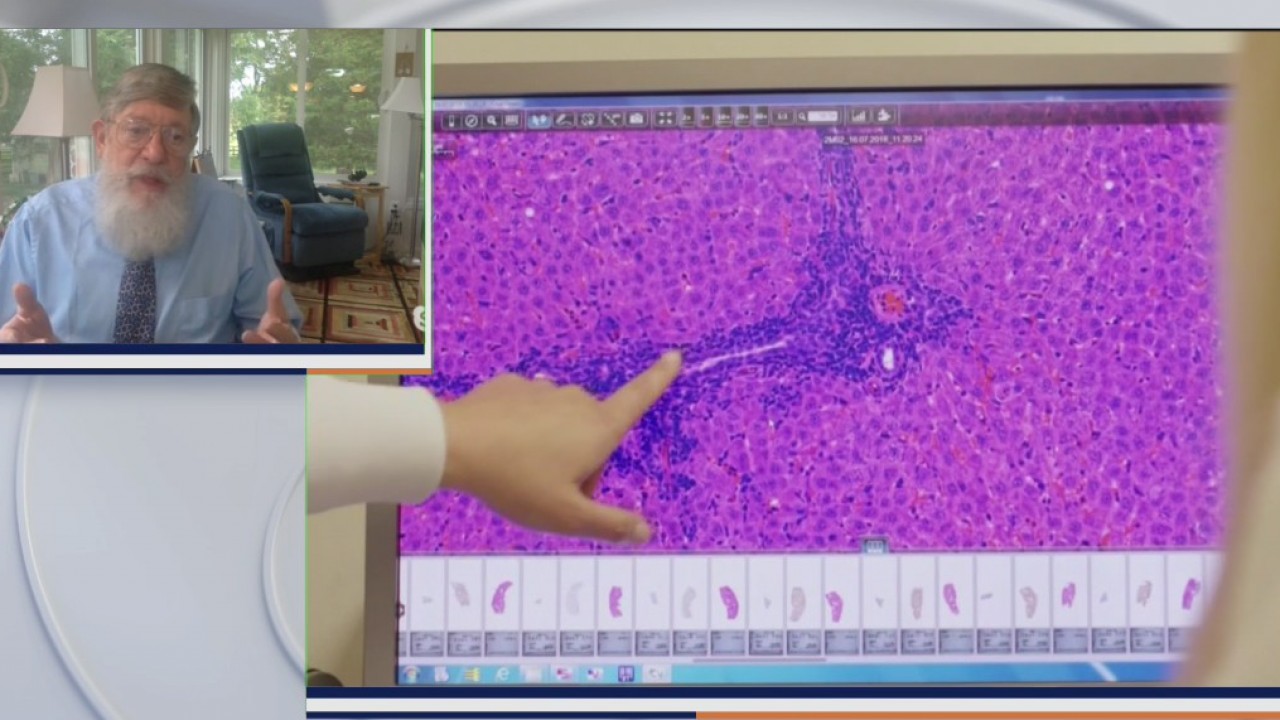 Dr. Williams Phillips explains human challenge trials for COVID-19