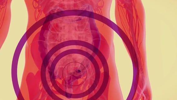 Colon cancer awareness