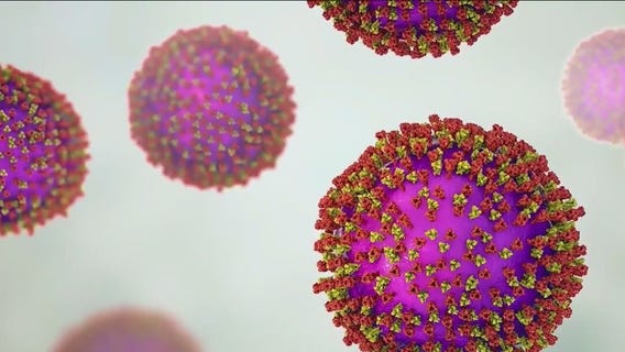 Second measles case confirmed in Will County, possible exposure risk