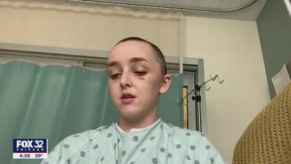 Chicago college student hit by falling debris speaks out