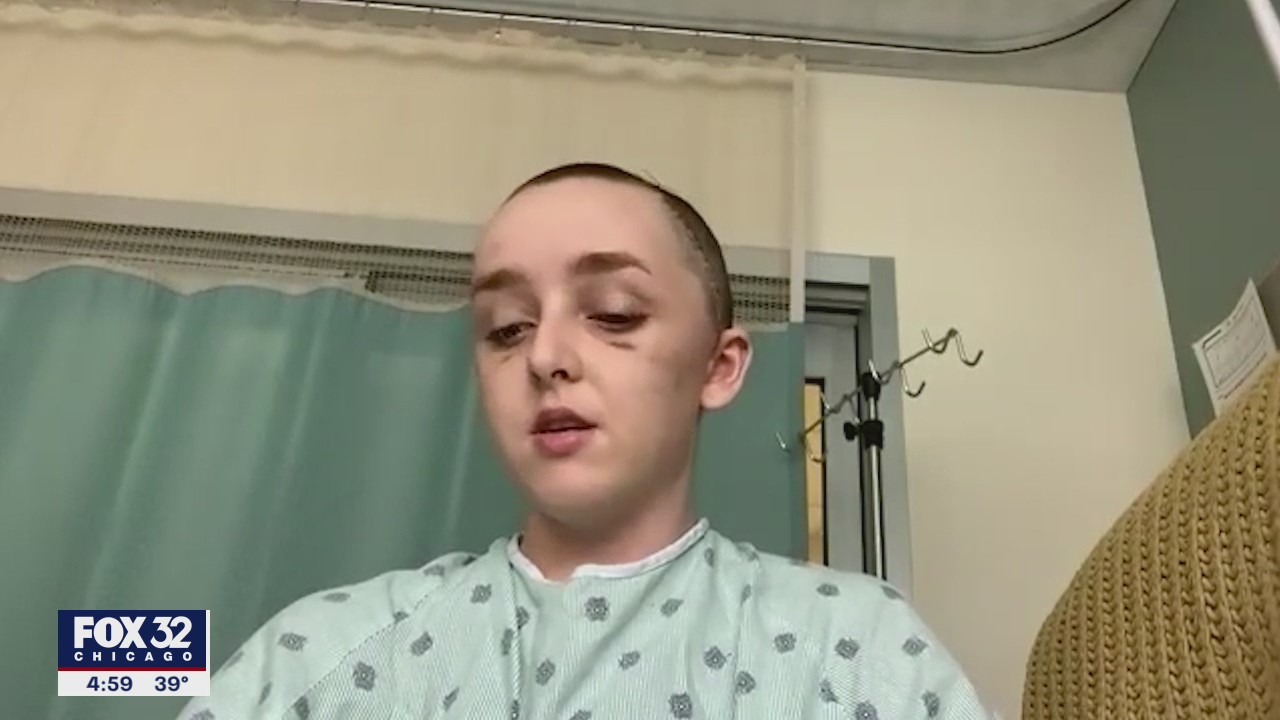 Chicago college student hit by falling debris speaks out