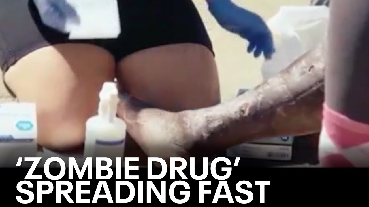 Zombie drug: Police, addiction services warn horrific new fentanyl mix 'Tranq' is deadly