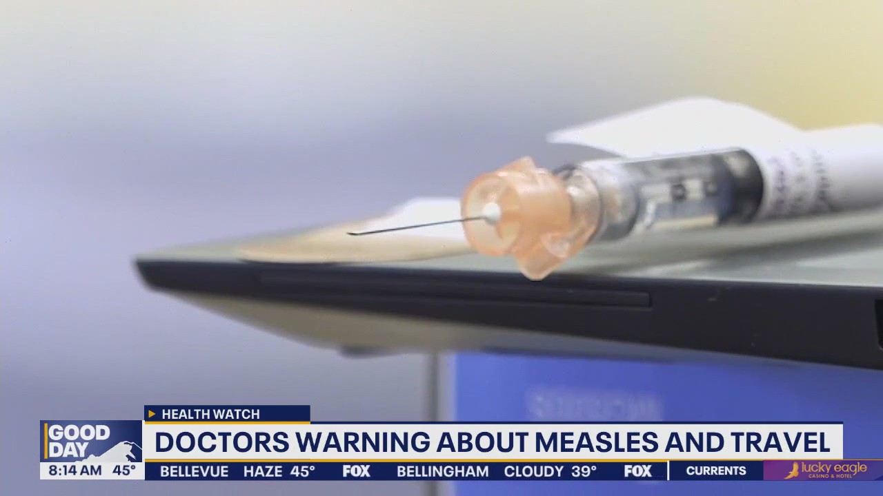 Doctors warning about measles and US travel