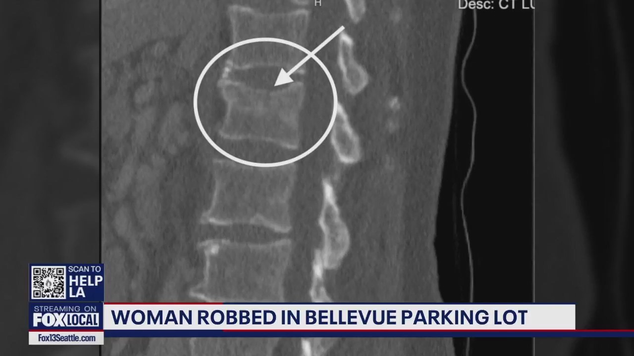 Woman robbed in Bellevue, WA parking lot