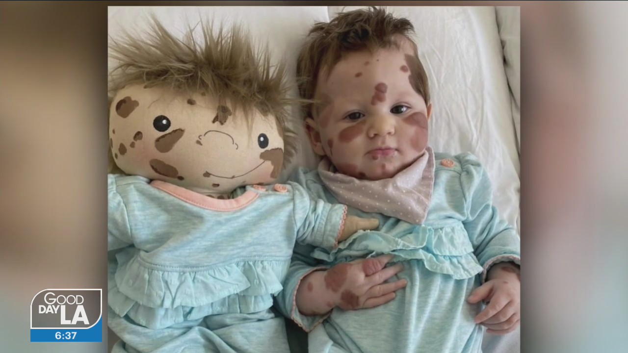 Changing children's lives one doll at a time