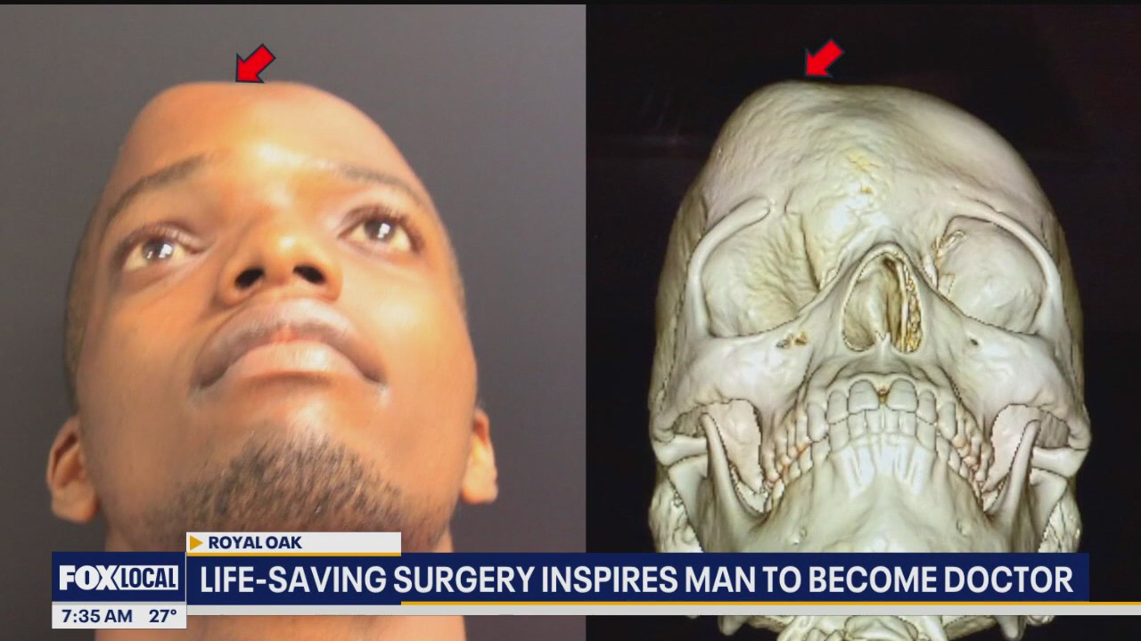 Life-saving surgery inspires man to become doctor