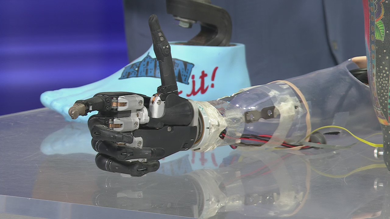 Anew Life Prosthetics and Orthotics, LLC