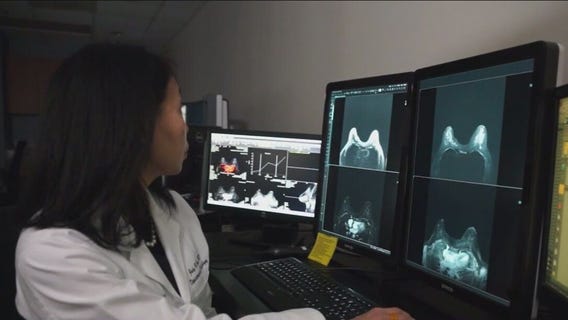 Latinas are 20% more likely to be diagnosed with late-stage breast cancer