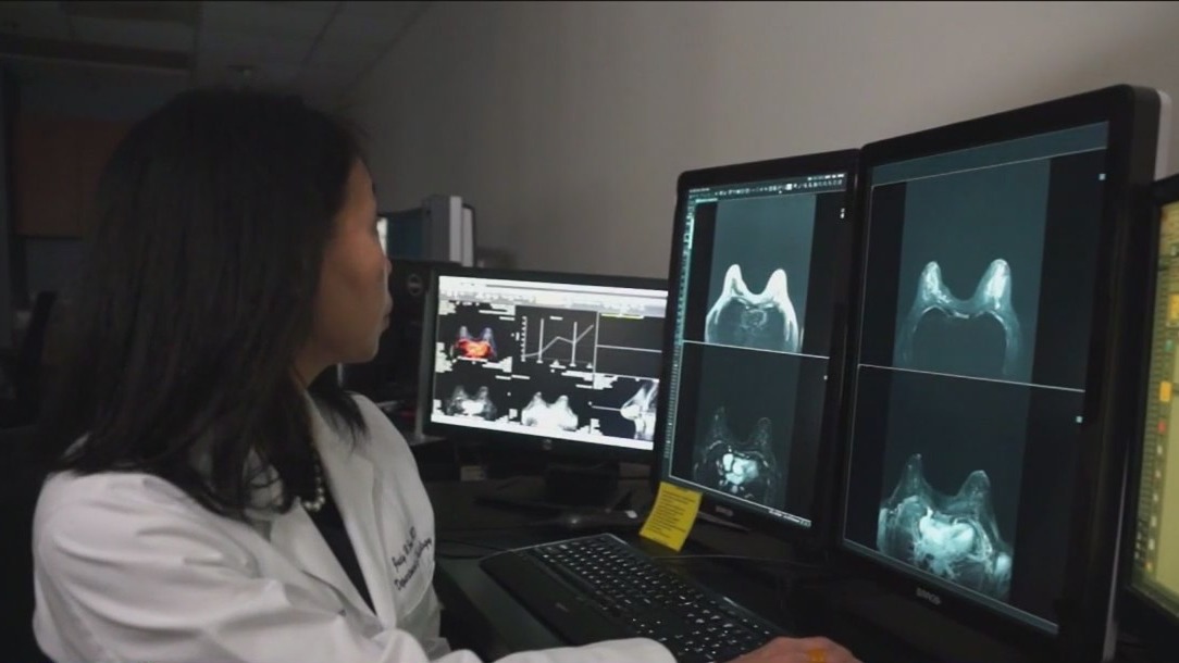 Latinas are 20% more likely to be diagnosed with late-stage breast cancer