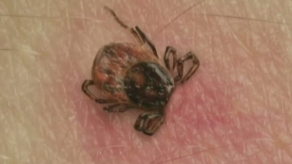 NYC Lyme disease fight