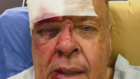 LA city volunteer recovering after bee attack