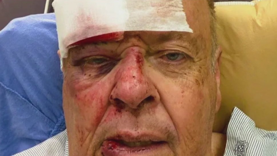 LA city volunteer recovering after bee attack