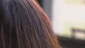 Nonprofits battles alopecia, hair loss