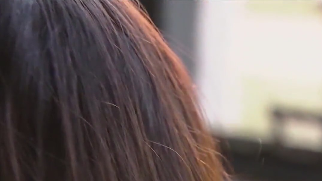 Nonprofits battles alopecia, hair loss