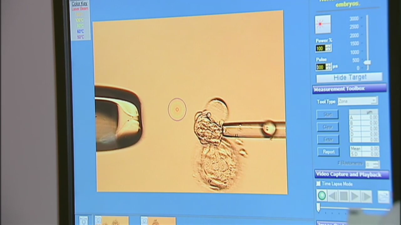 Egg freezing up as women delay having kids