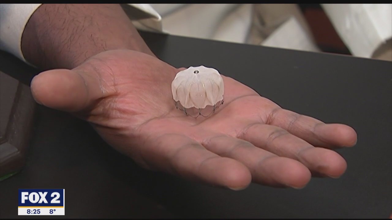 The Doctor Is In: New Device keeping Afib patients off blood thinners