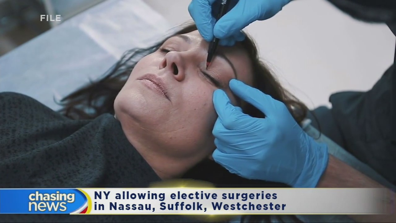 A plastic surgeon says patients are booking ahead