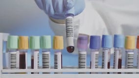 Artificial Intelligence making a difference in health care industry