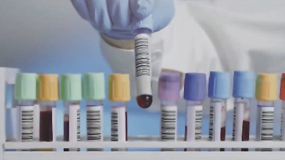 Artificial Intelligence making a difference in health care industry