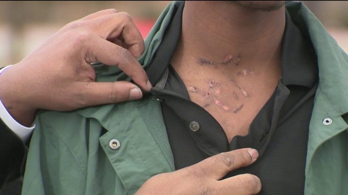 Teen tased by police on school bus speaks out