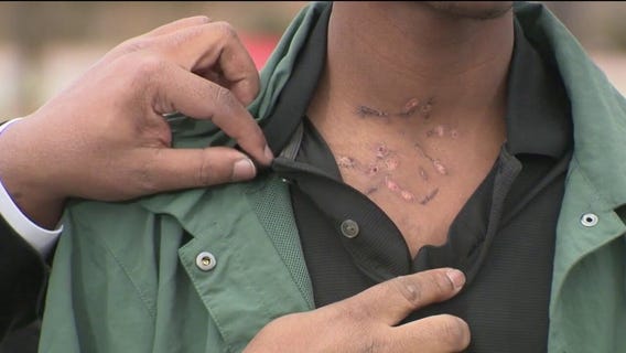 Teen tased by police on school bus speaks out