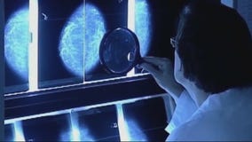 Cancer cases rise for women, drop for men l FOX 10 Talks