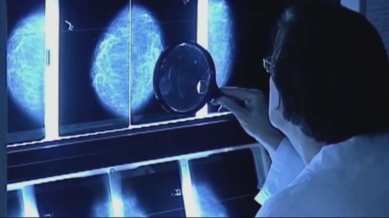 Cancer cases rise for women, drop for men l FOX 10 Talks