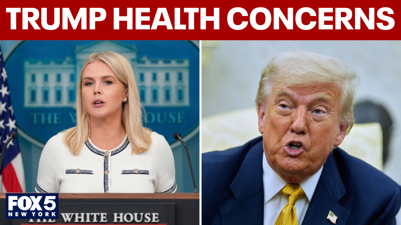 Trump diagnosed with chronic venous insufficiency