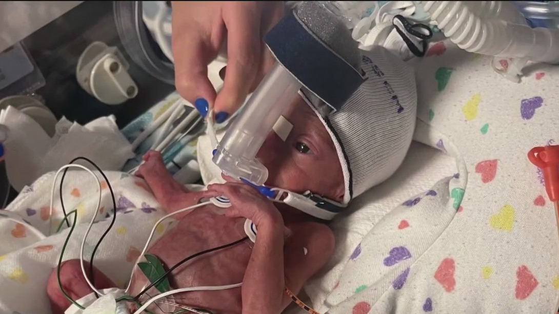 Premature baby gets fighting chance