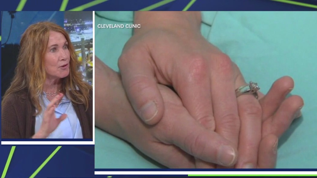 Benefits of hormone replacement therapy