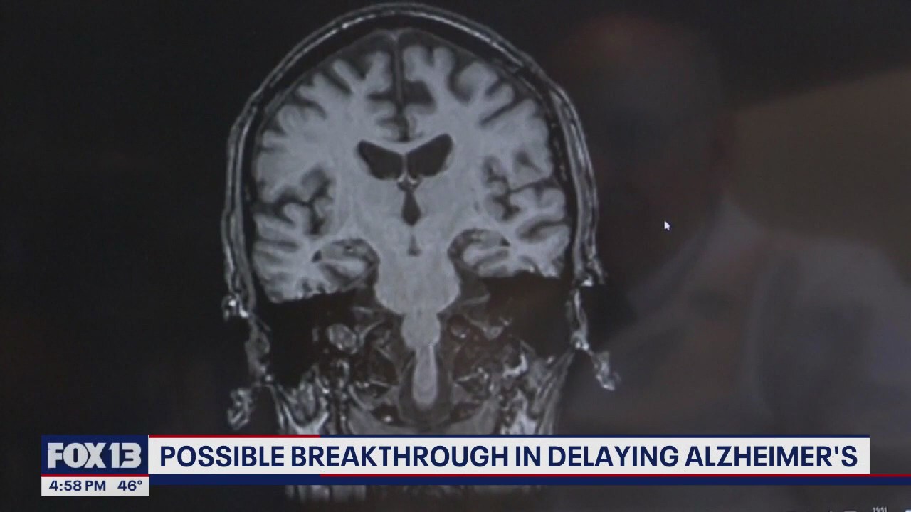 Possible breakthrough in delaying Alzheimer's