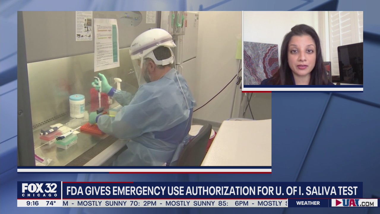 U of I saliva test shows promise in fighting COVID-19