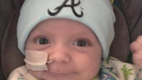 Acworth boy thriving years after heart surgery